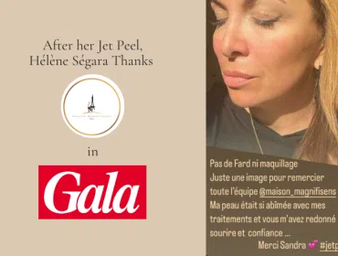 Hélène Ségara Thanks Maison Magnifisens for Her Jet Peel