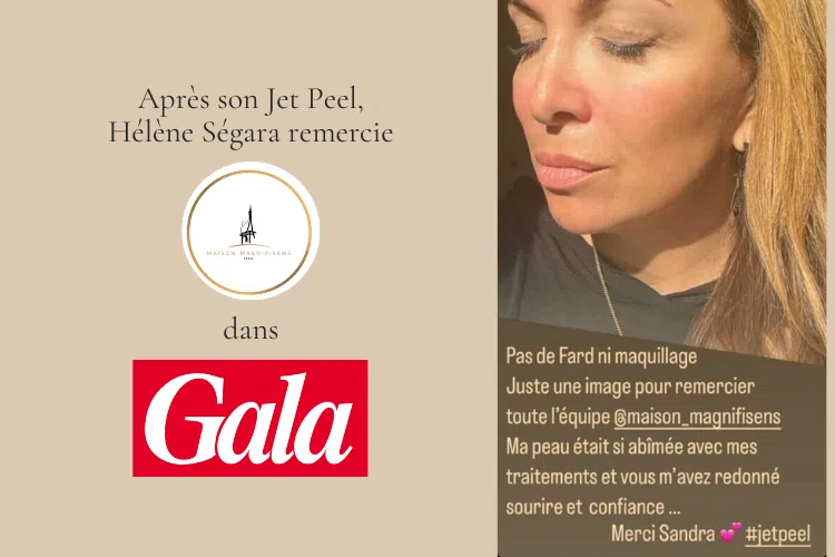 Hélène Ségara remercie Maison Magnifisens pour son Jet Peel